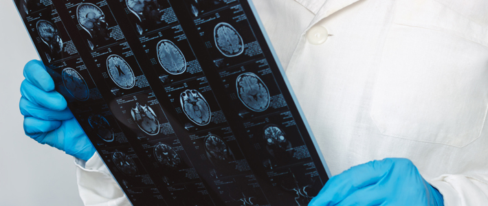 Doctor holding brain X-ray