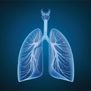 ExpertMRI low dose lung CT screening