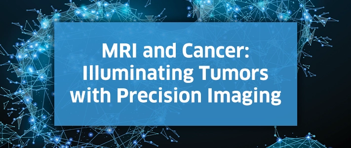MRI and Cancer: Illuminating Tumors with Precision Imaging